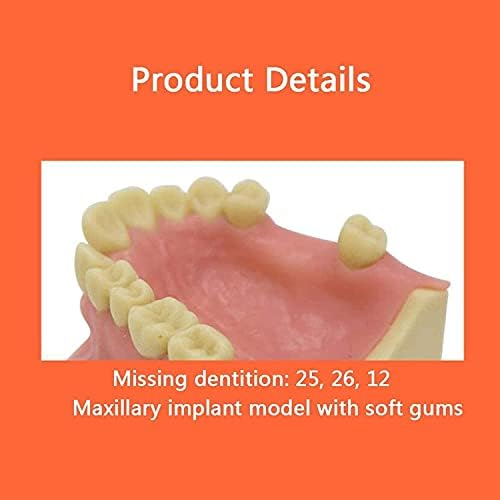 Diş Diş Modeli, Modeli Oral İmplant Uygulama Modeli, Diş Modeli için Diş İmplant Gösteri Uygulama Öğretim