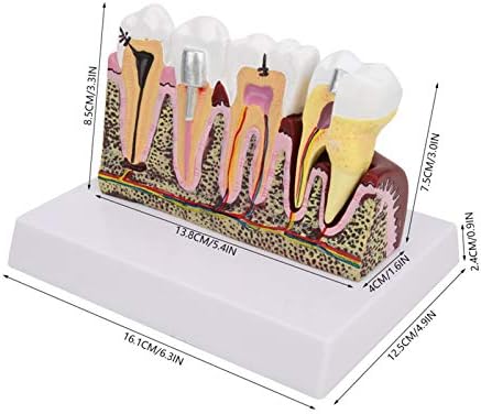 Modeli Diş, Reçine Ağız Boşluğu Ayrılabilir Fizyolojik Diş Diş Modeli, Öğrenciler için Diş Hekimi