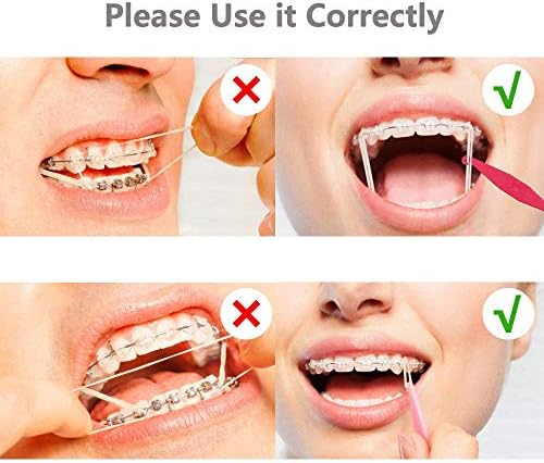 300 Adet DentalSmile Amber 1/4 Elastik Lastik Bantlar Lateks Parantez 3.5 oz MediumDental Ortodontik Lateks Bantları Diş Hekimi
