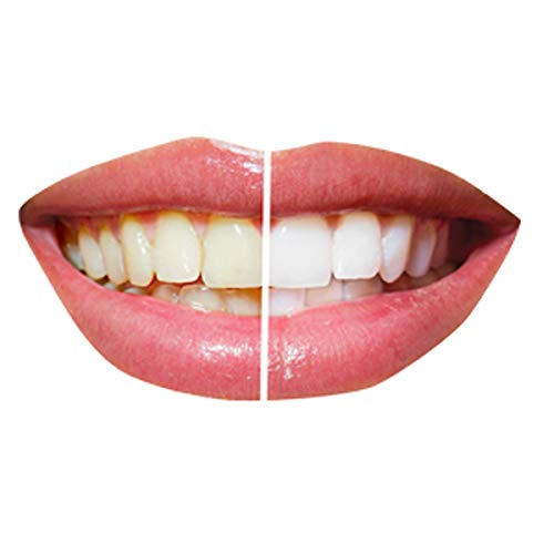 Wyfun Yedek Diş Fırçası Kafaları için Oral B Elektrikli Diş Fırçası, Pro Beyaz, Hassas Sakız Bakımı, Sensi, Beyazlatma Fırça