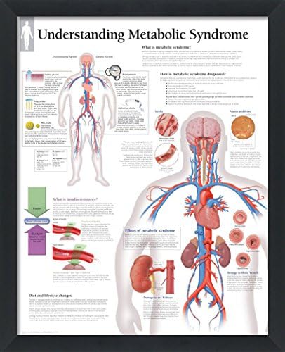 4 Çerçeveli Tıbbi Poster Seti Diyabeti Anlamak Kolesterolü Anlamak Metabolik Sendromu Anlamak ve Hepatiti Anlamak 22 x 28 Duvar